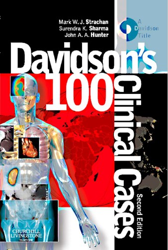 Davidsons's 100 Clinical Cases , Second Edition
