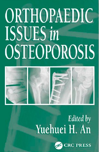 Orthopaedic Issues In Osteoporosis