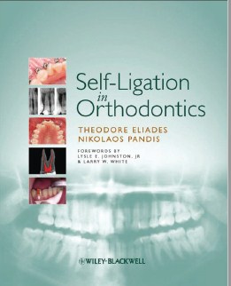 Self-Ligation in Orthodontics An evidence-based approach to biomechanics and treatment
